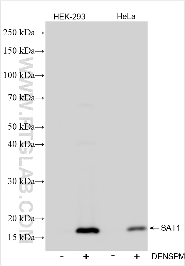 WB analysis using 83319-1-RR (same clone as 83319-1-PBS)