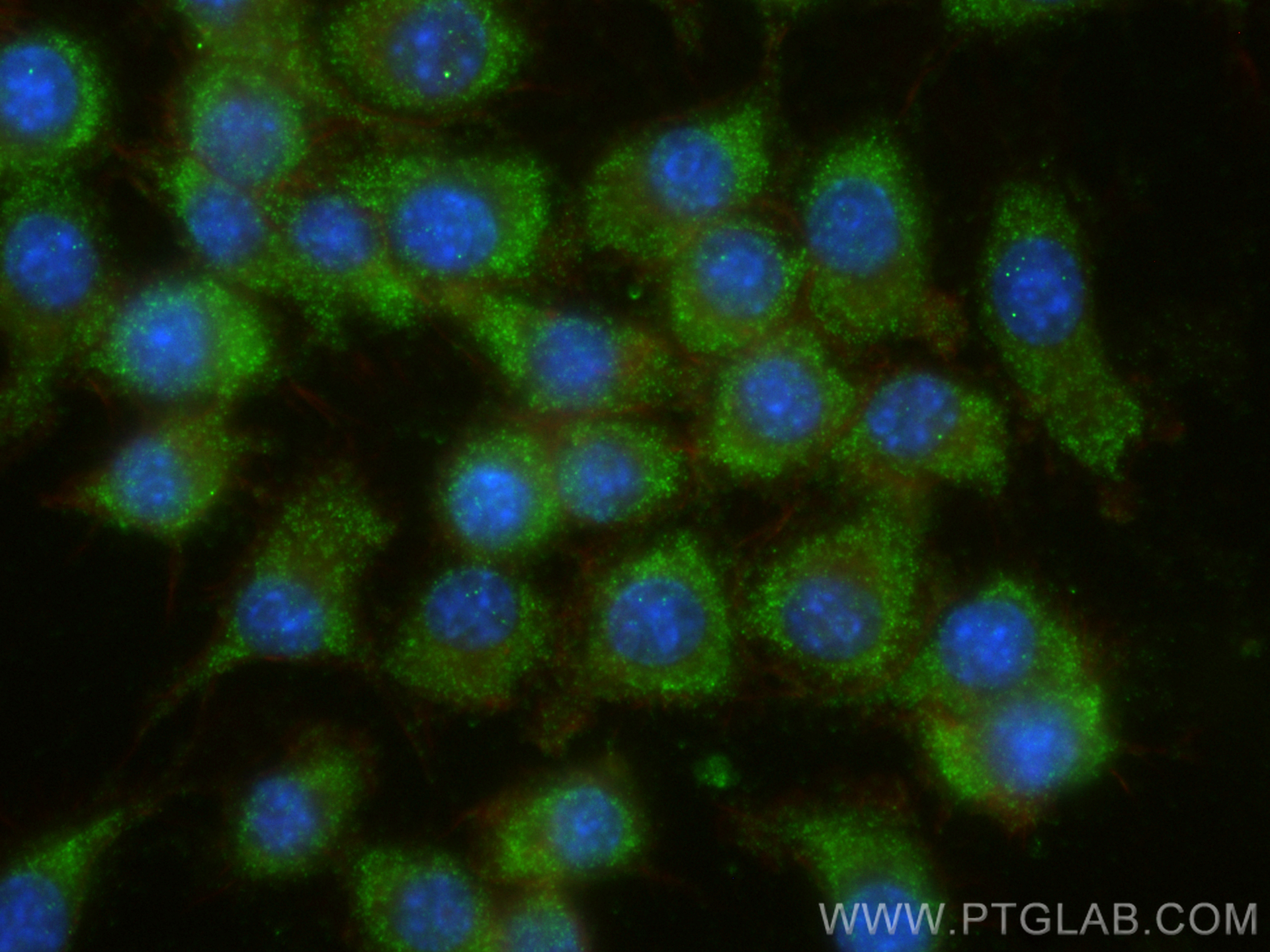 IF Staining of RAW 264.7 using RMX00008
