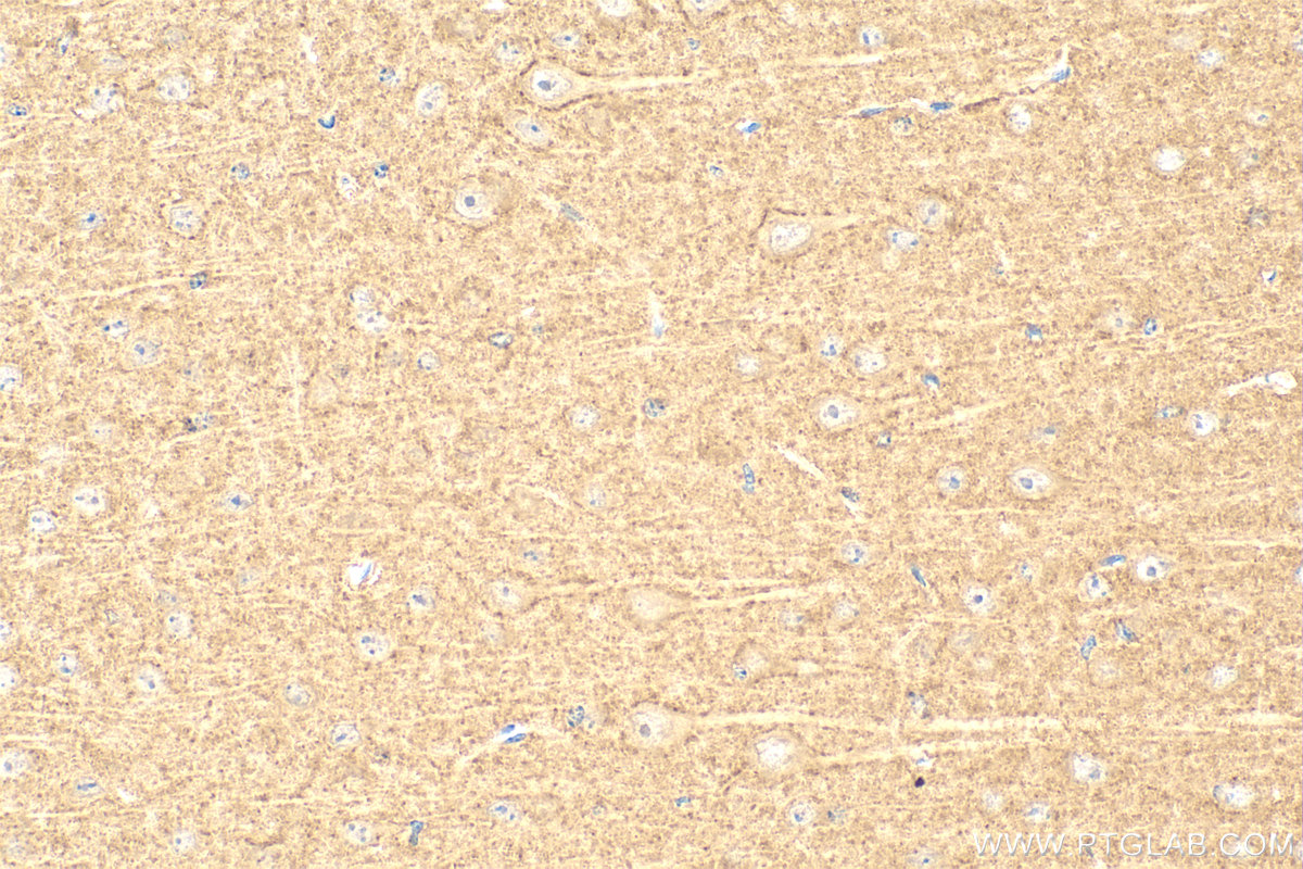 IHC staining of mouse brain using RMX00008