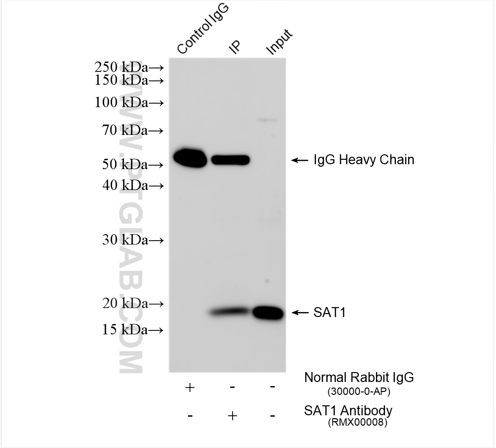 IP result of anti-SAT1 (IP:RMX00008, 4ug; Detection:RMX00008 1:1500) with DENSPM treated HEK-293 cells lysate 1288 ug. IP experiment of HEK-293 using RMX00008