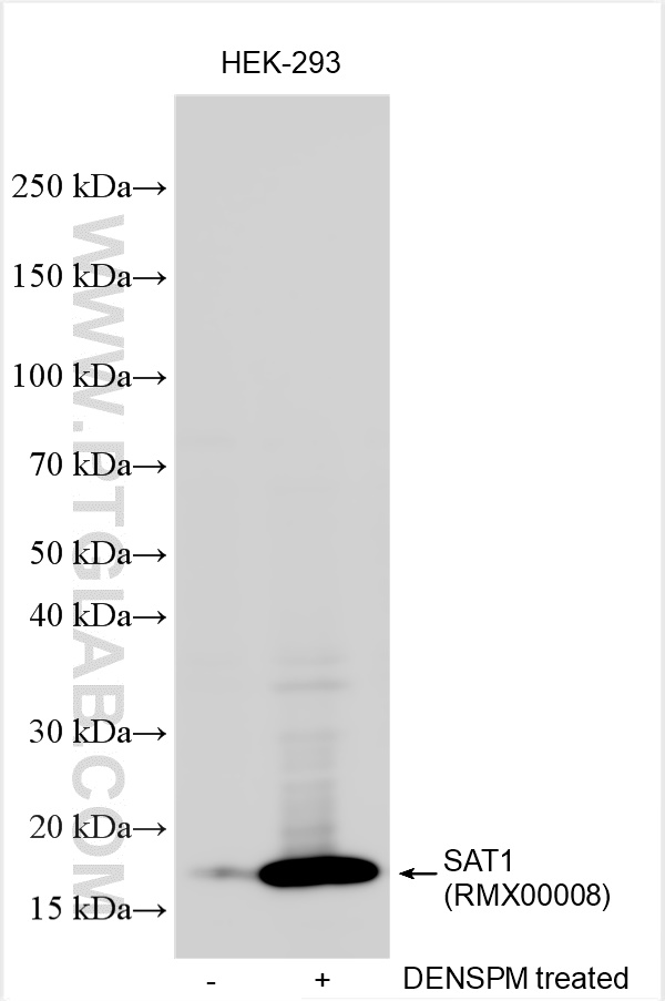 WB analysis using RMX00008