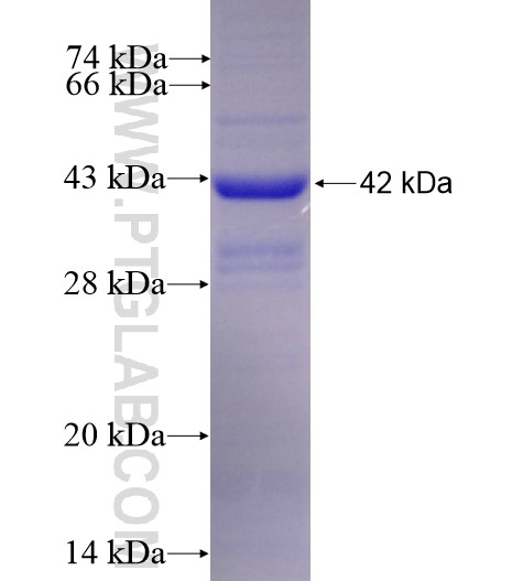 SATB1 fusion protein Ag12278 SDS-PAGE SATB1 fusion protein Ag12278 SDS-PAGE