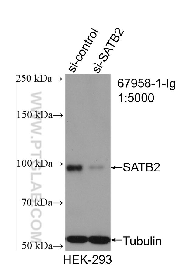 WB analysis of HEK-293 using 67958-1-Ig