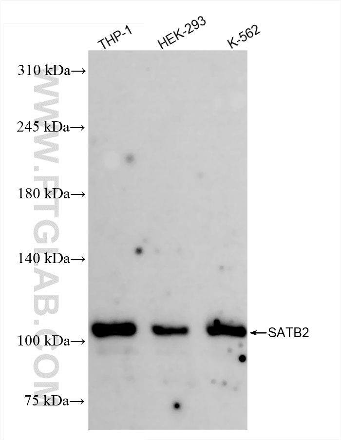 WB analysis using 85922-3-RR