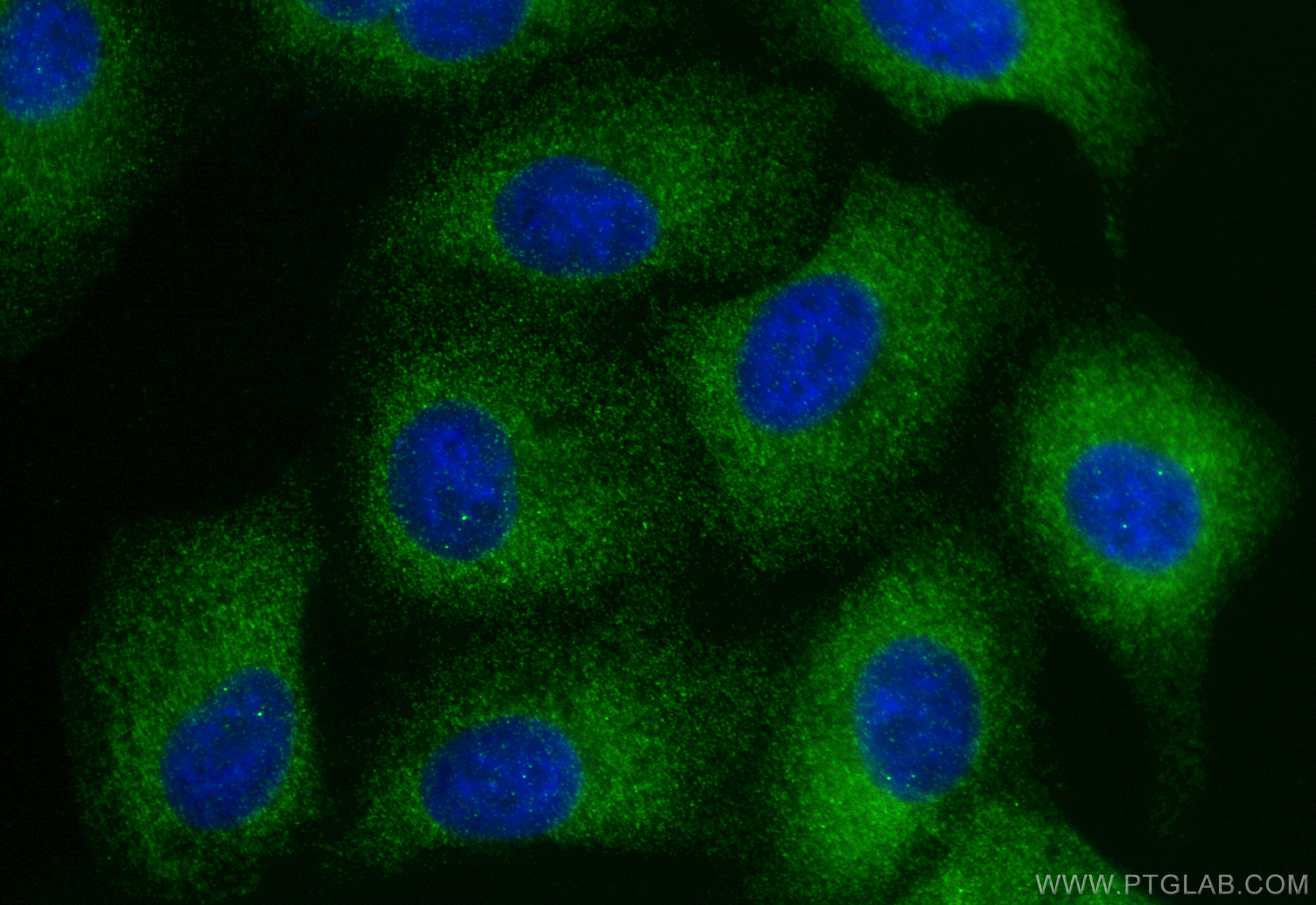 IF Staining of A549 using 32277-1-AP