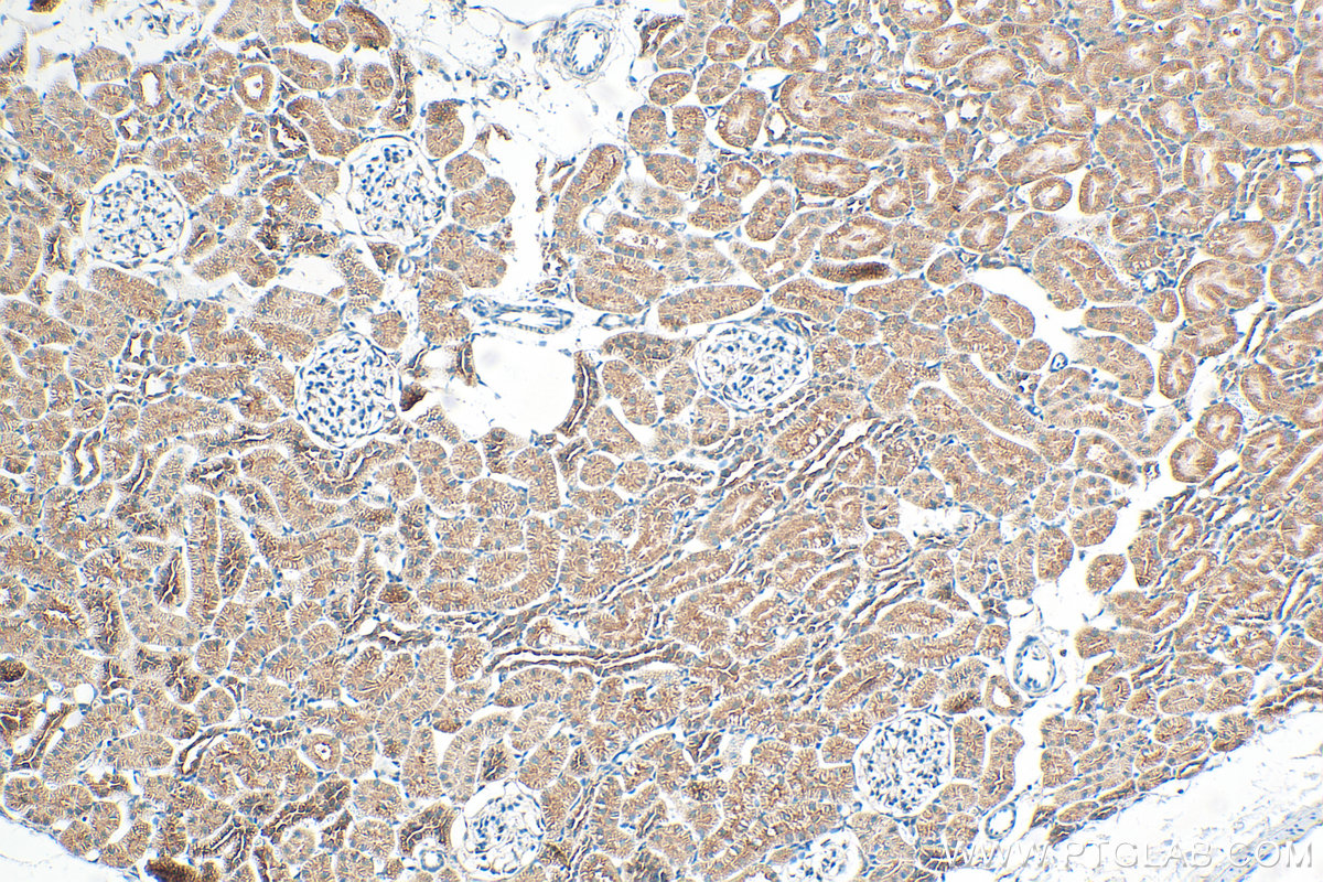 IHC staining of rat kidney using 32277-1-AP