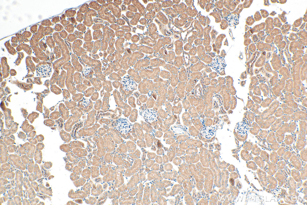 IHC staining of mouse kidney using 32277-1-AP