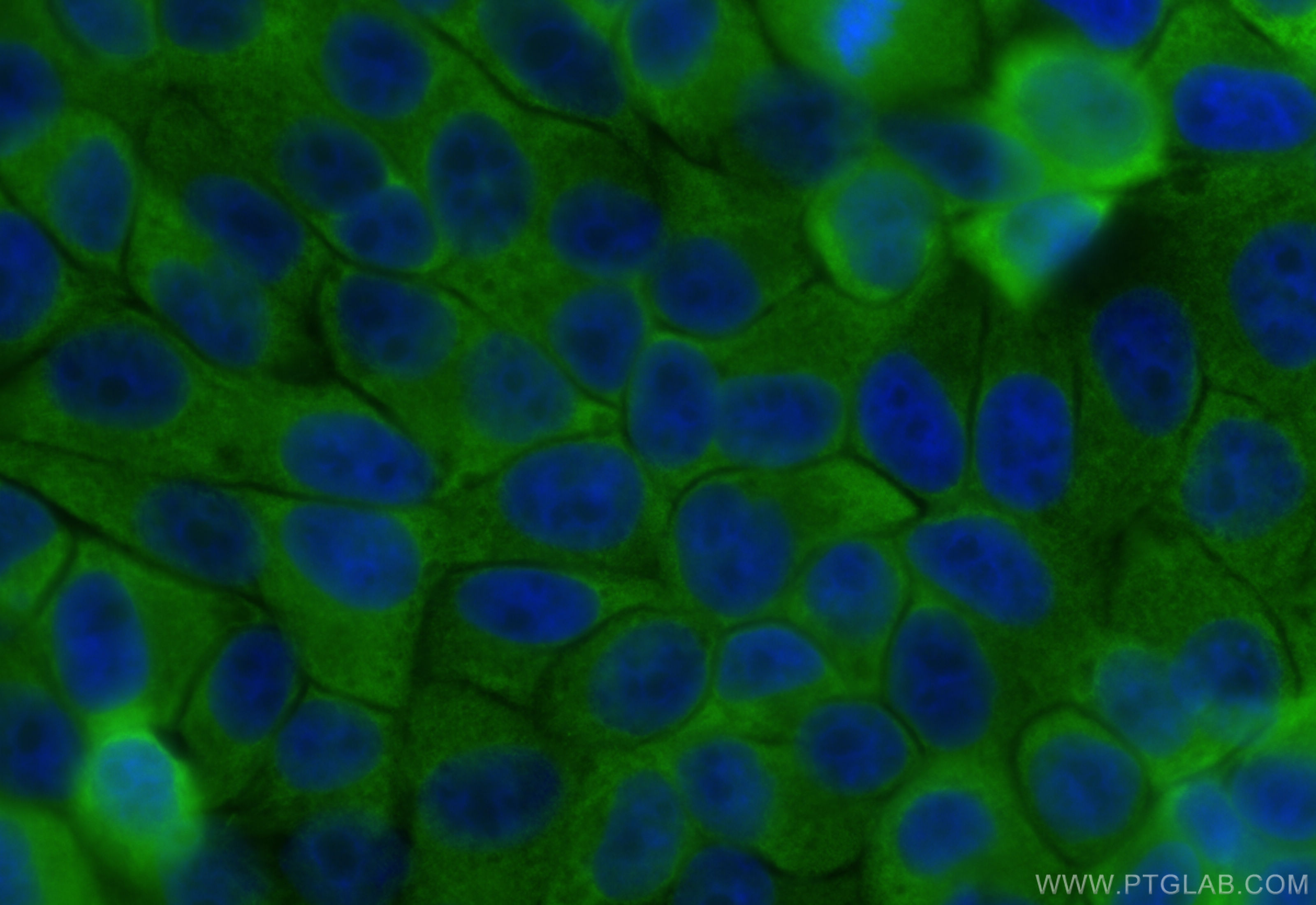 IF Staining of HepG2 using 67200-1-Ig (same clone as 67200-1-PBS)