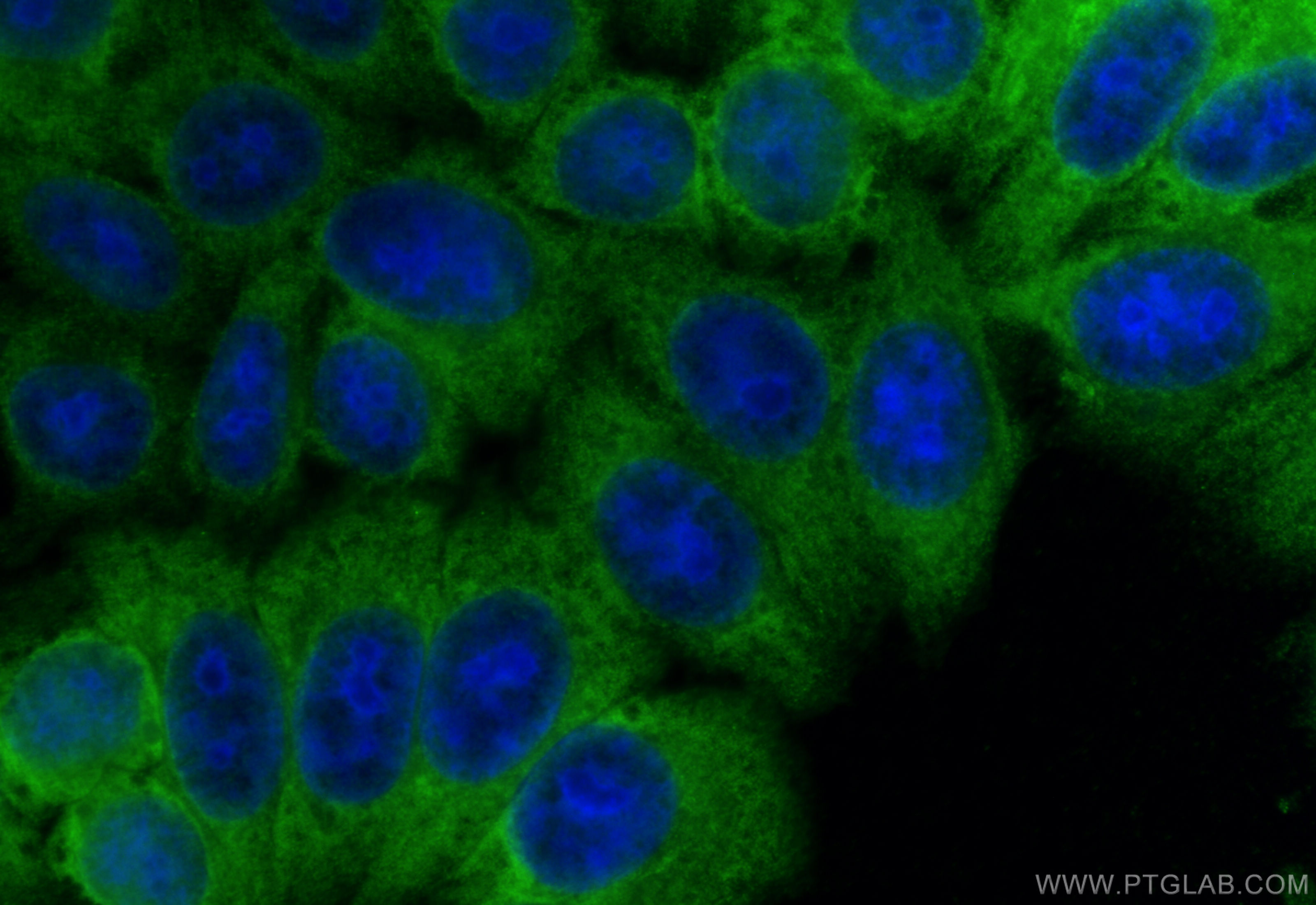 IF Staining of HepG2 using 67200-1-Ig (same clone as 67200-1-PBS)