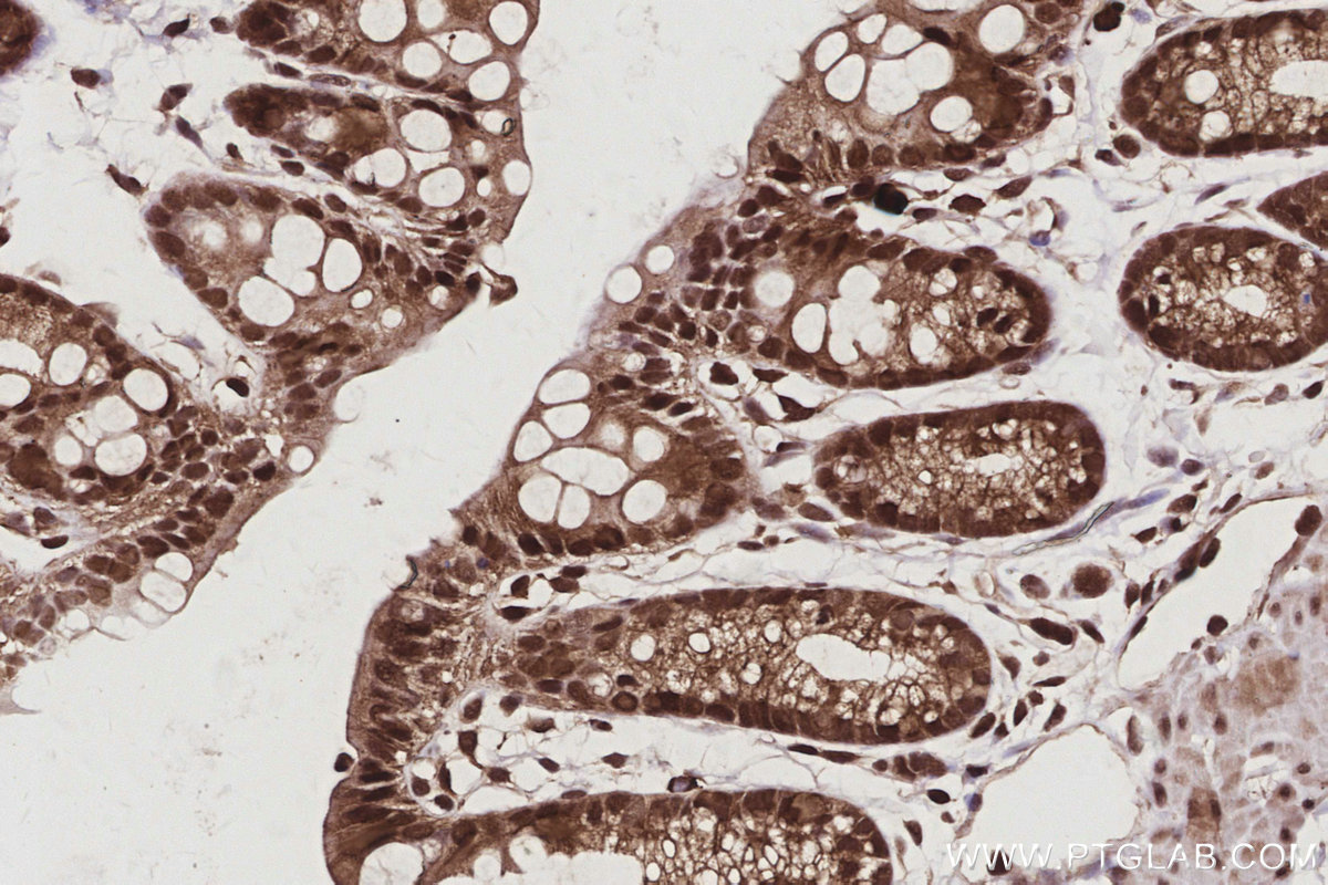 IHC staining of mouse colon using 67200-1-Ig