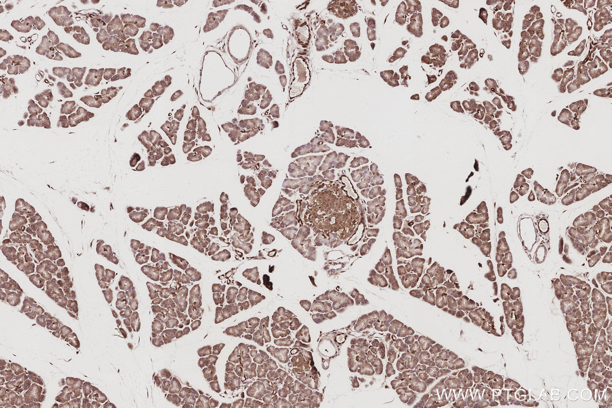 IHC staining of rat pancreas using 67200-1-Ig