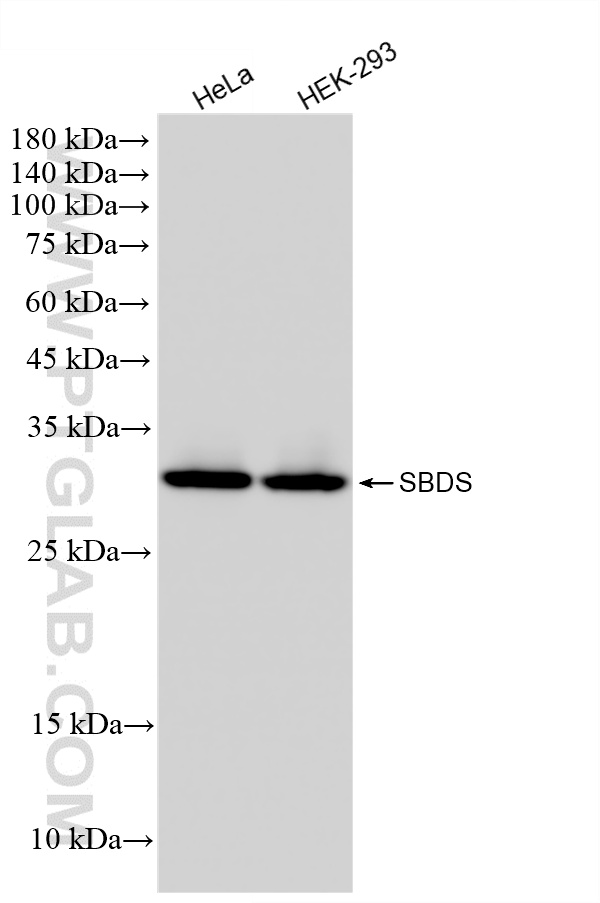 WB analysis using 67200-1-Ig WB analysis using 67200-1-Ig