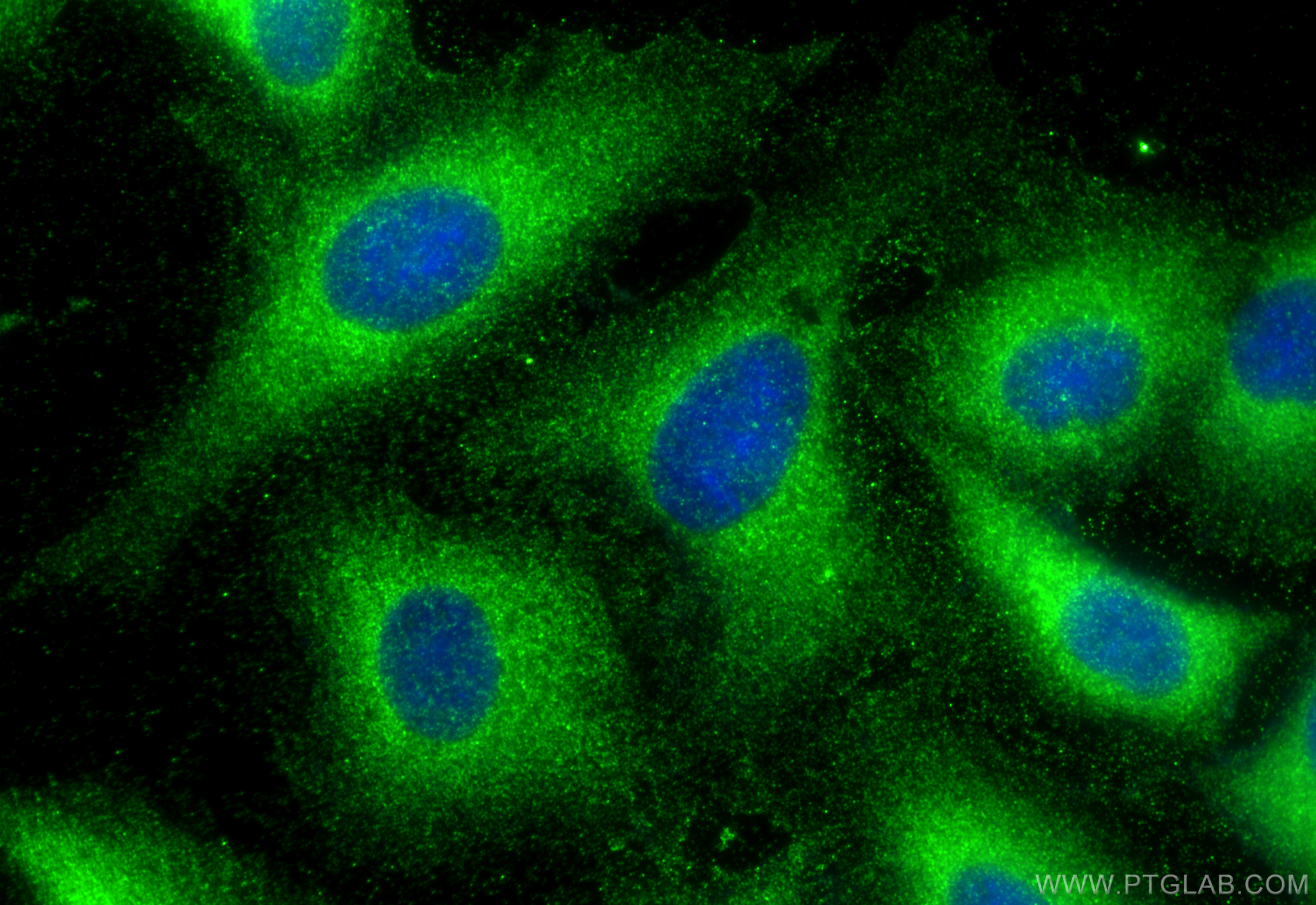 IF Staining of A549 using 32117-1-AP