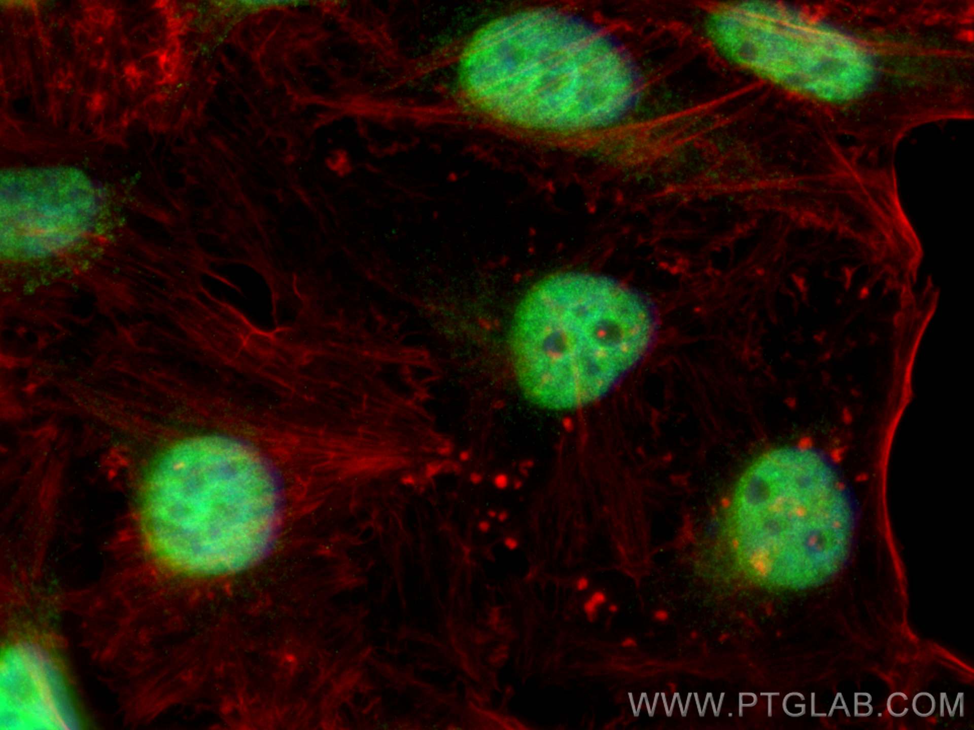 Immunofluorescent analysis of (4% PFA) fixed HeLa cells using SBNO1 antibody (25359-1-AP) at dilution of 1:200 and CoraLite®488-Conjugated Goat Anti-Rabbit IgG(H+L) (<a class='green' href='/productredirect?CatalogNo=SA00013-2' target='_blank'>SA00013-2</a>), CL594-phalloidin (red). IF Staining of HeLa using 25359-1-AP