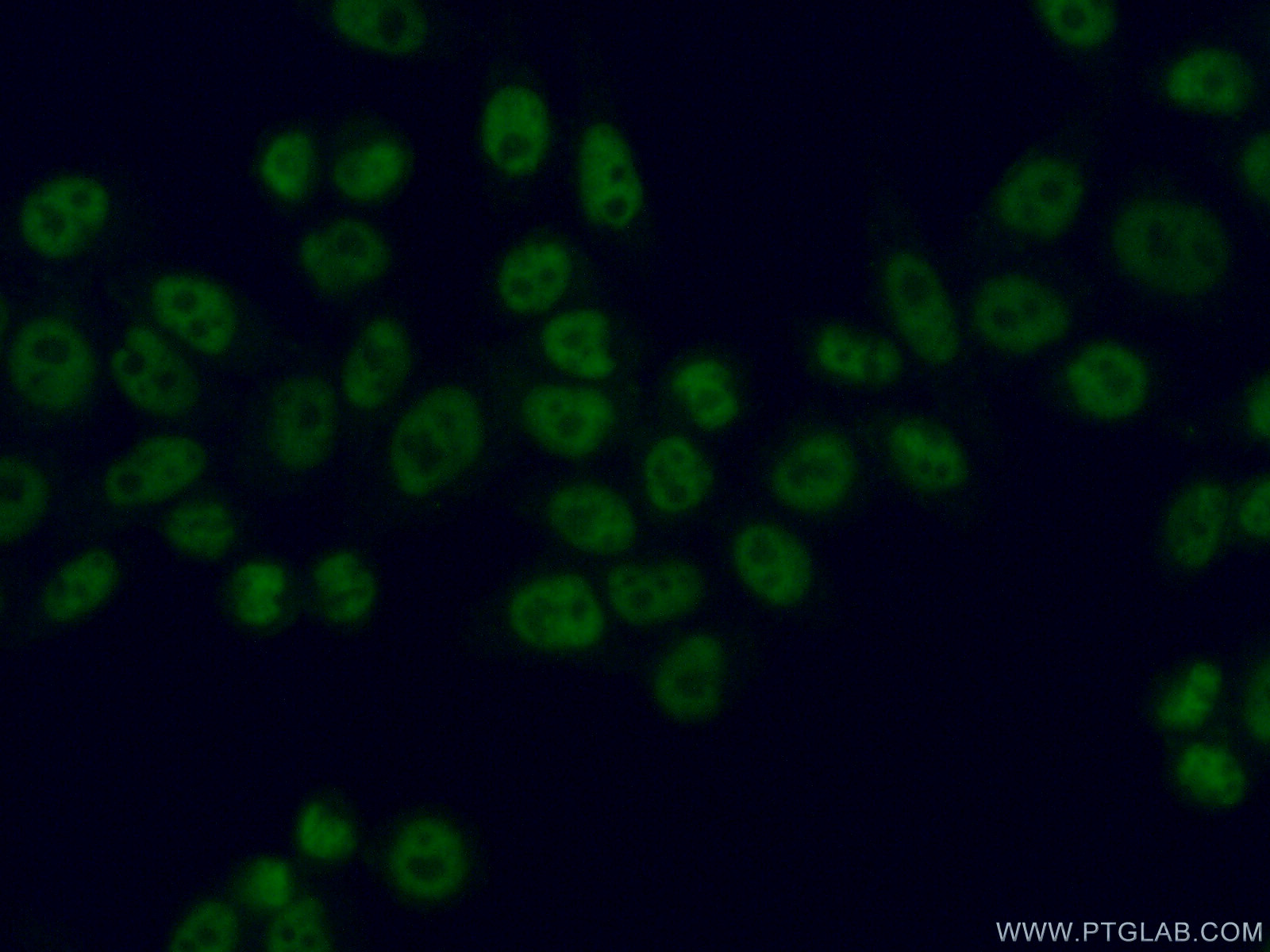 IF Staining of HeLa using 25359-1-AP