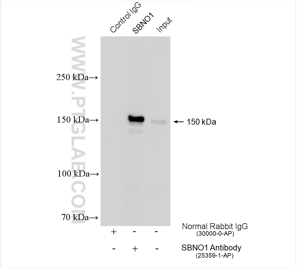 IP result of anti-SBNO1 (IP:25359-1-AP, 4ug; Detection:25359-1-AP 1:3000) with Jurkat cells lysate 1400 ug. IP experiment of Jurkat using 25359-1-AP