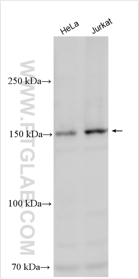 Various lysates were subjected to SDS PAGE followed by western blot with 25359-1-AP (SBNO1 antibody) at dilution of 1:4000 incubated at room temperature for 1.5 hours. WB analysis using 25359-1-AP