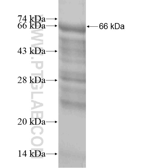 SBNO1 fusion protein Ag18942 SDS-PAGE SBNO1 fusion protein Ag18942 SDS-PAGE