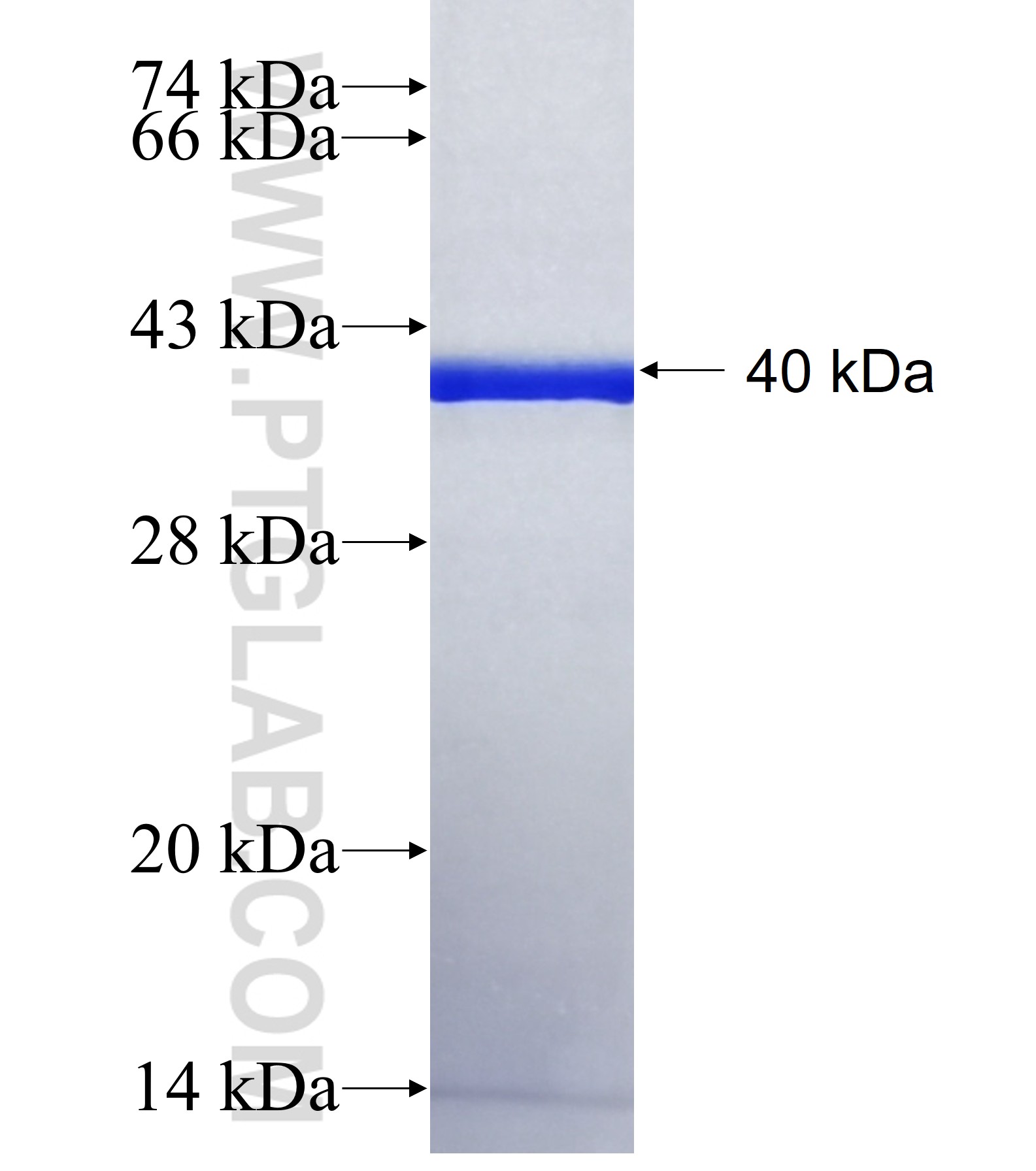 SBNO2 fusion protein Ag41144 SDS-PAGE SBNO2 fusion protein Ag41144 SDS-PAGE