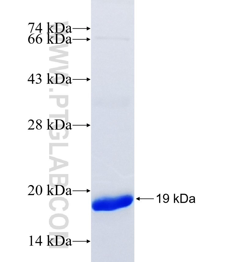 SBNO2 fusion protein Ag41152 SDS-PAGE SBNO2 fusion protein Ag41152 SDS-PAGE