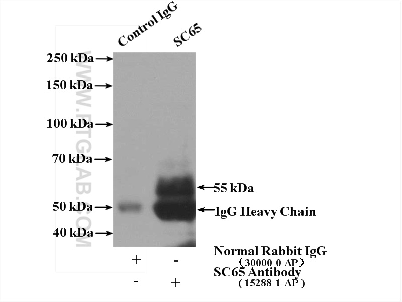 IP experiment of mouse bladder using 15288-1-AP