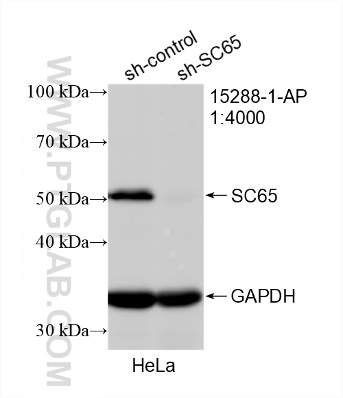 WB analysis of HeLa using 15288-1-AP (same clone as 15288-1-PBS)