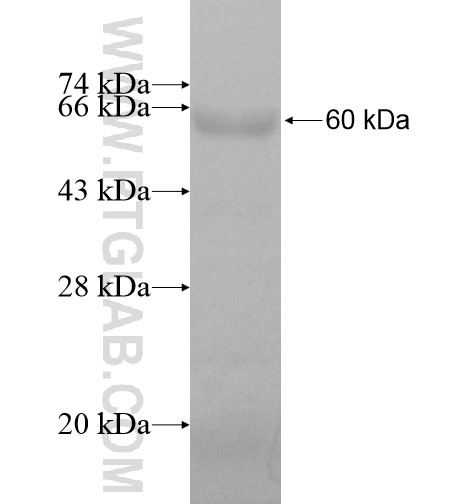 SCAF1 fusion protein Ag11556 SDS-PAGE SCAF1 fusion protein Ag11556 SDS-PAGE