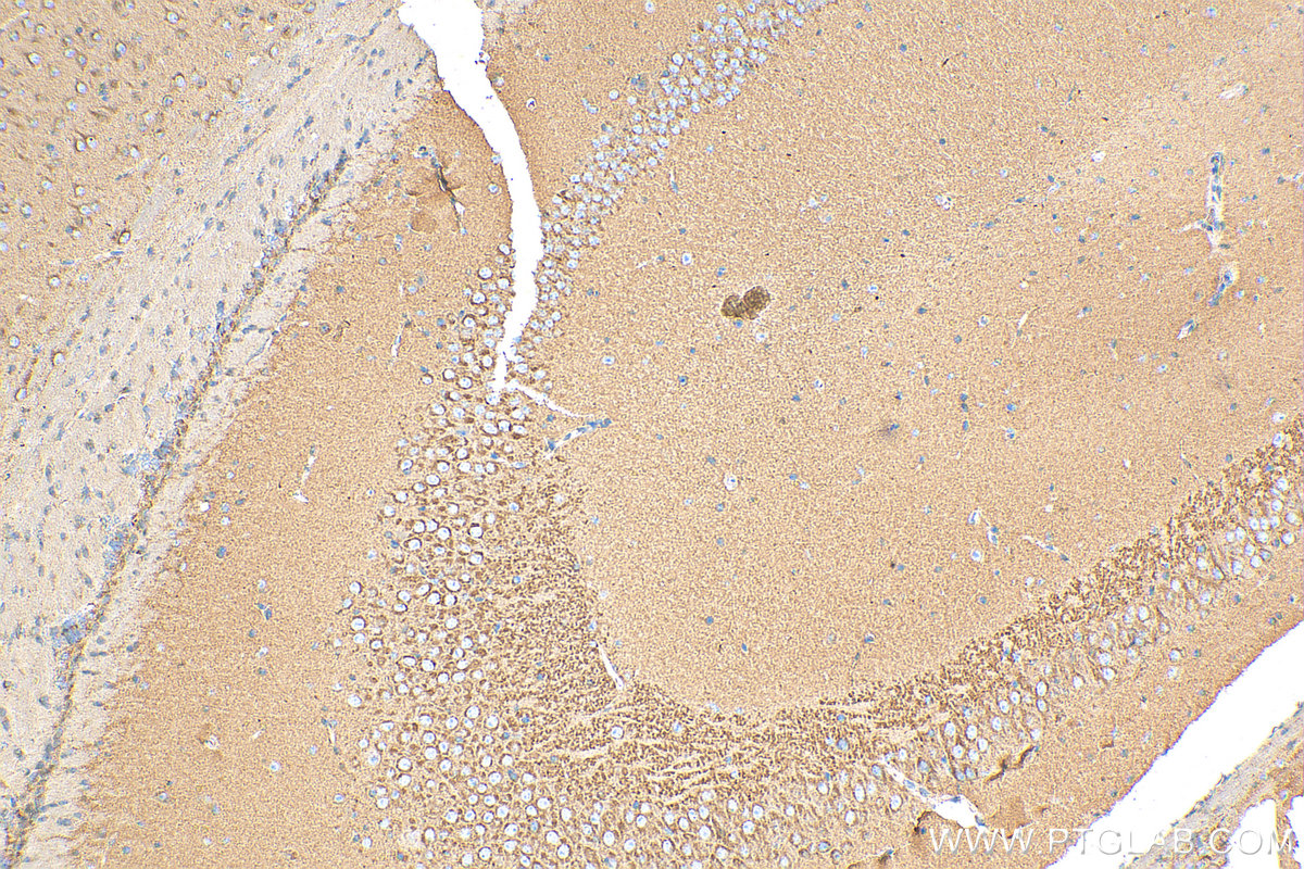 IHC staining of mouse brain using 15327-1-AP