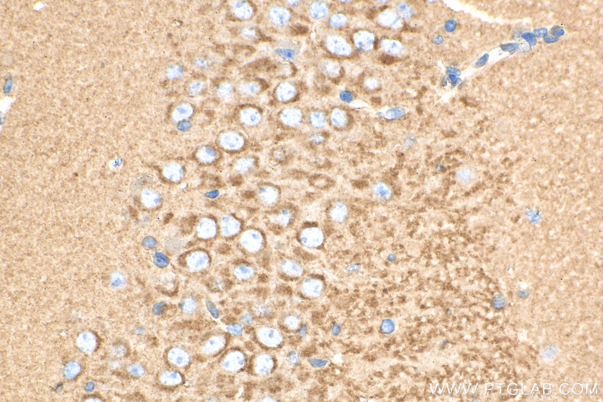 IHC staining of mouse brain using 15327-1-AP
