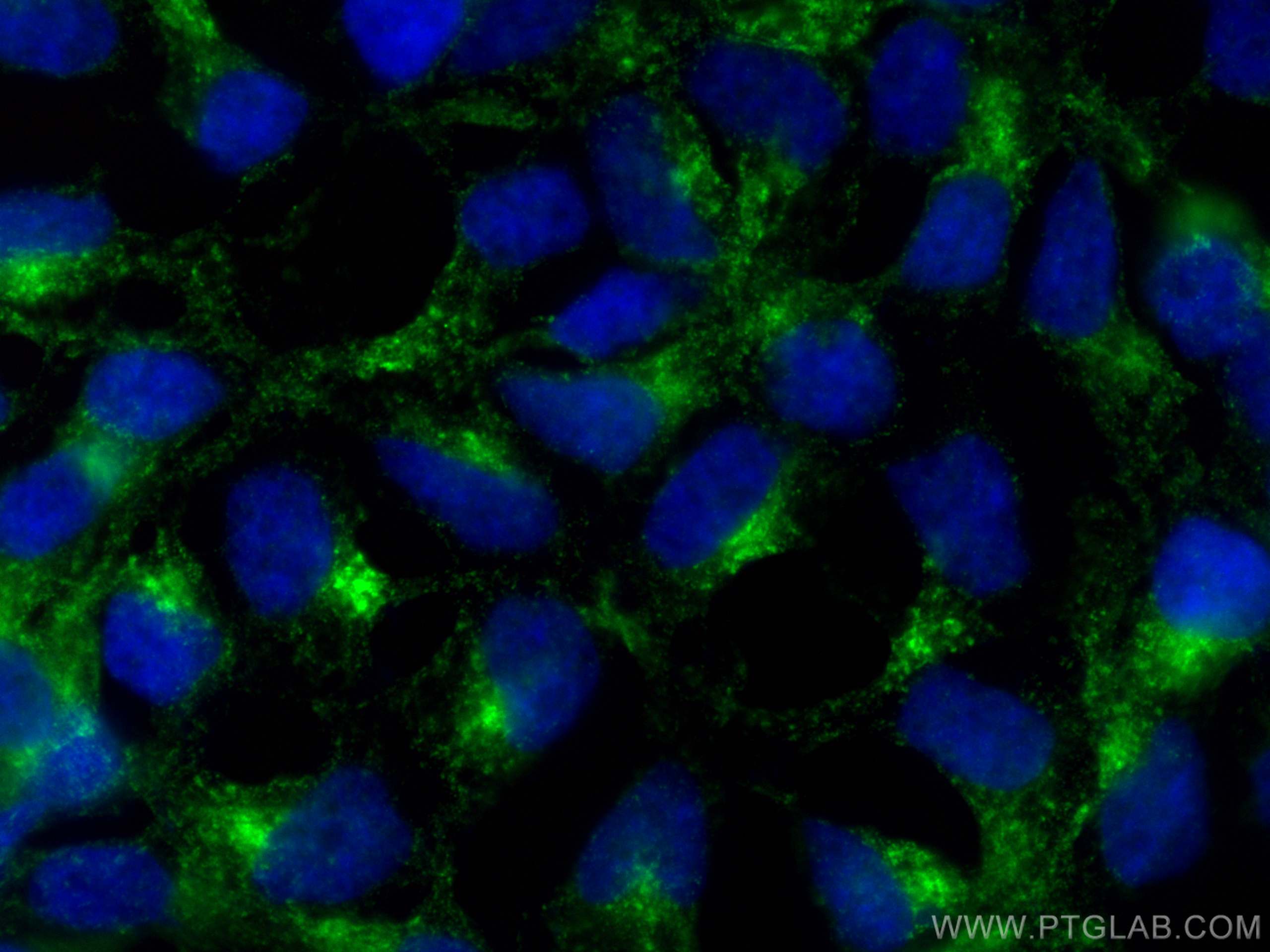 IF Staining of HEK-293 using 15119-1-AP