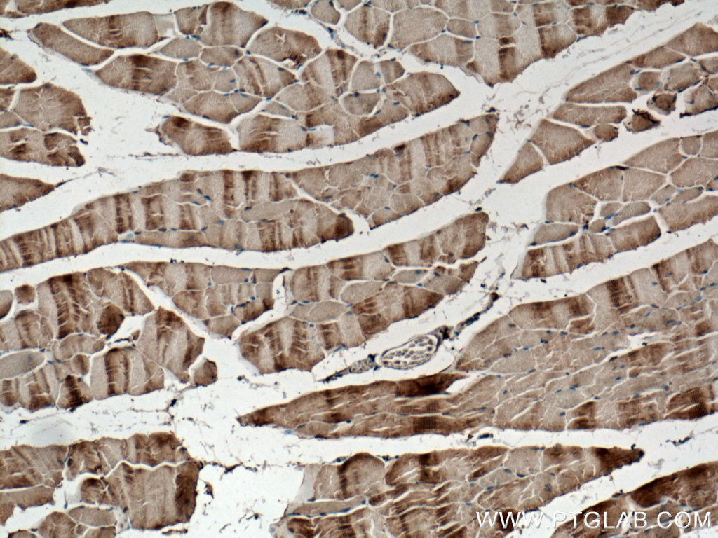 IHC staining of mouse skeletal muscle using 26888-1-AP