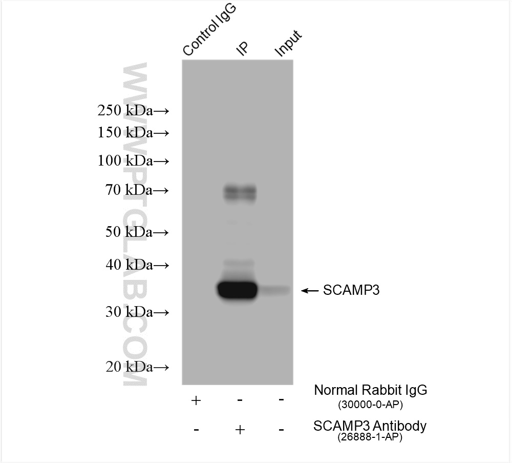 IP result of anti-SCAMP3 (IP:26888-1-AP, 4ug; Detection:26888-1-AP 1:5000) with HepG2 cells lysate 1480 ug. IP experiment of HepG2 using 26888-1-AP