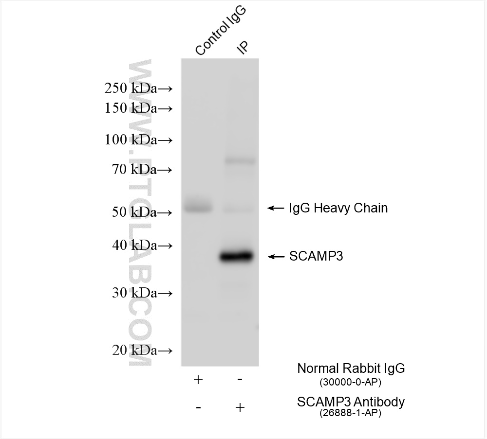 IP result of anti-SCAMP3 (IP:26888-1-AP, 4ug; Detection:26888-1-AP 1:5000) with mouse heart tissue lysate 1880 ug. IP experiment of mouse heart using 26888-1-AP