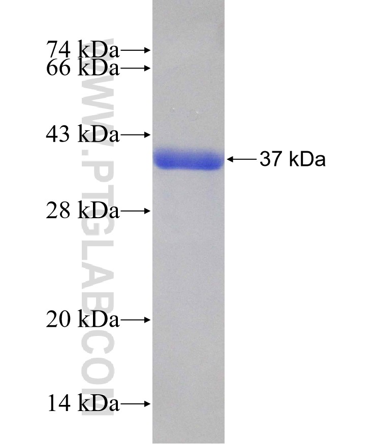 SCAMP3 fusion protein Ag25256 SDS-PAGE