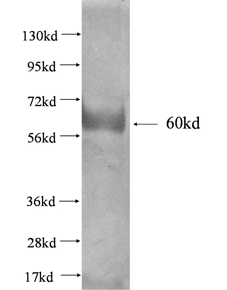 SCAMP3 fusion protein Ag2262 SDS-PAGE