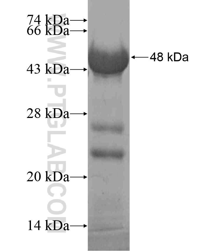 SCAND3 fusion protein Ag17408 SDS-PAGE SCAND3 fusion protein Ag17408 SDS-PAGE