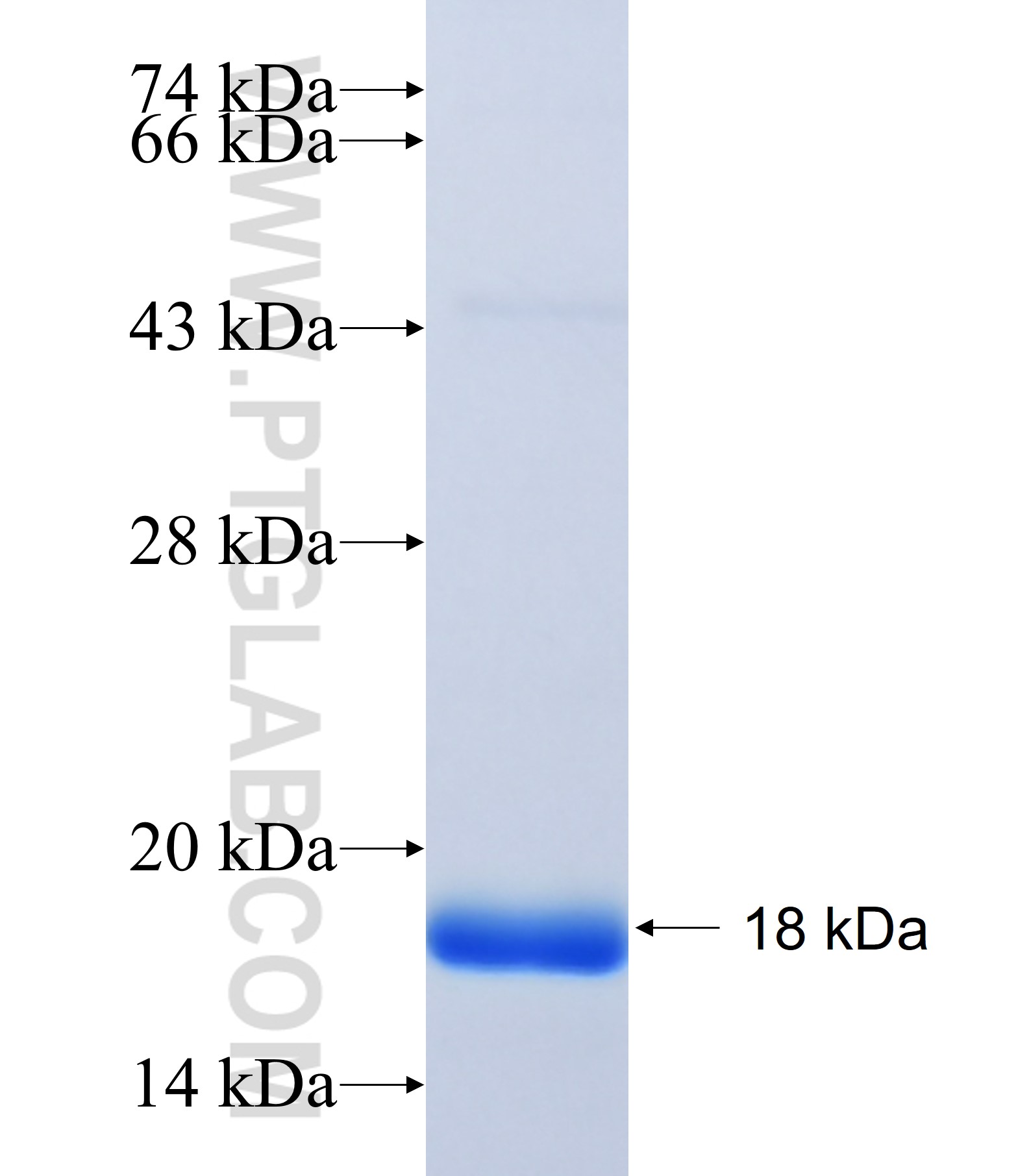 SCAP fusion protein Ag39749 SDS-PAGE