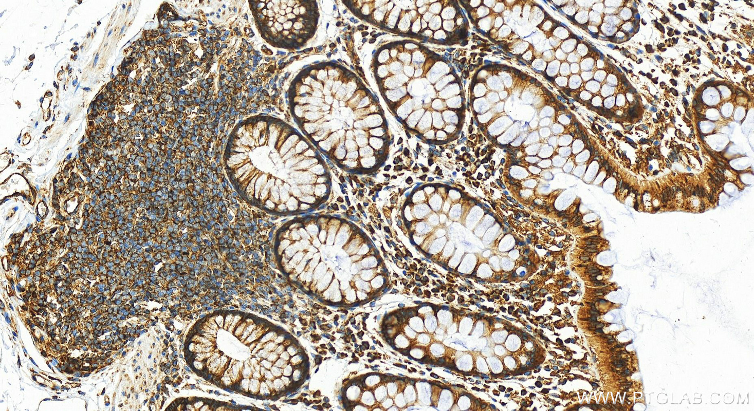 IHC staining of human colon using 14799-1-AP