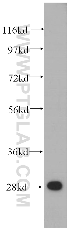 WB analysis of HeLa using 14799-1-AP