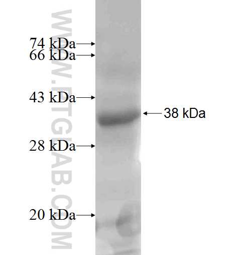 SCARA3 fusion protein Ag5051 SDS-PAGE SCARA3 fusion protein Ag5051 SDS-PAGE