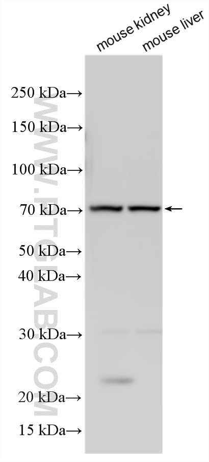 Various lysates were subjected to SDS PAGE followed by western blot with <a class='green' href='/productredirect?CatalogNo=21277-1-AP' target='_blank'>21277-1-AP</a> (SR-BI antibody) at dilution of 1:3000 incubated at room temperature for 1.5 hours. This data was developed using the same antibody clone with 21277-1-PBS in a different storage buffer formulation. WB analysis using 21277-1-AP (same clone as 21277-1-PBS)