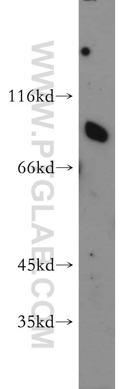 SR-BI Polyclonal antibody