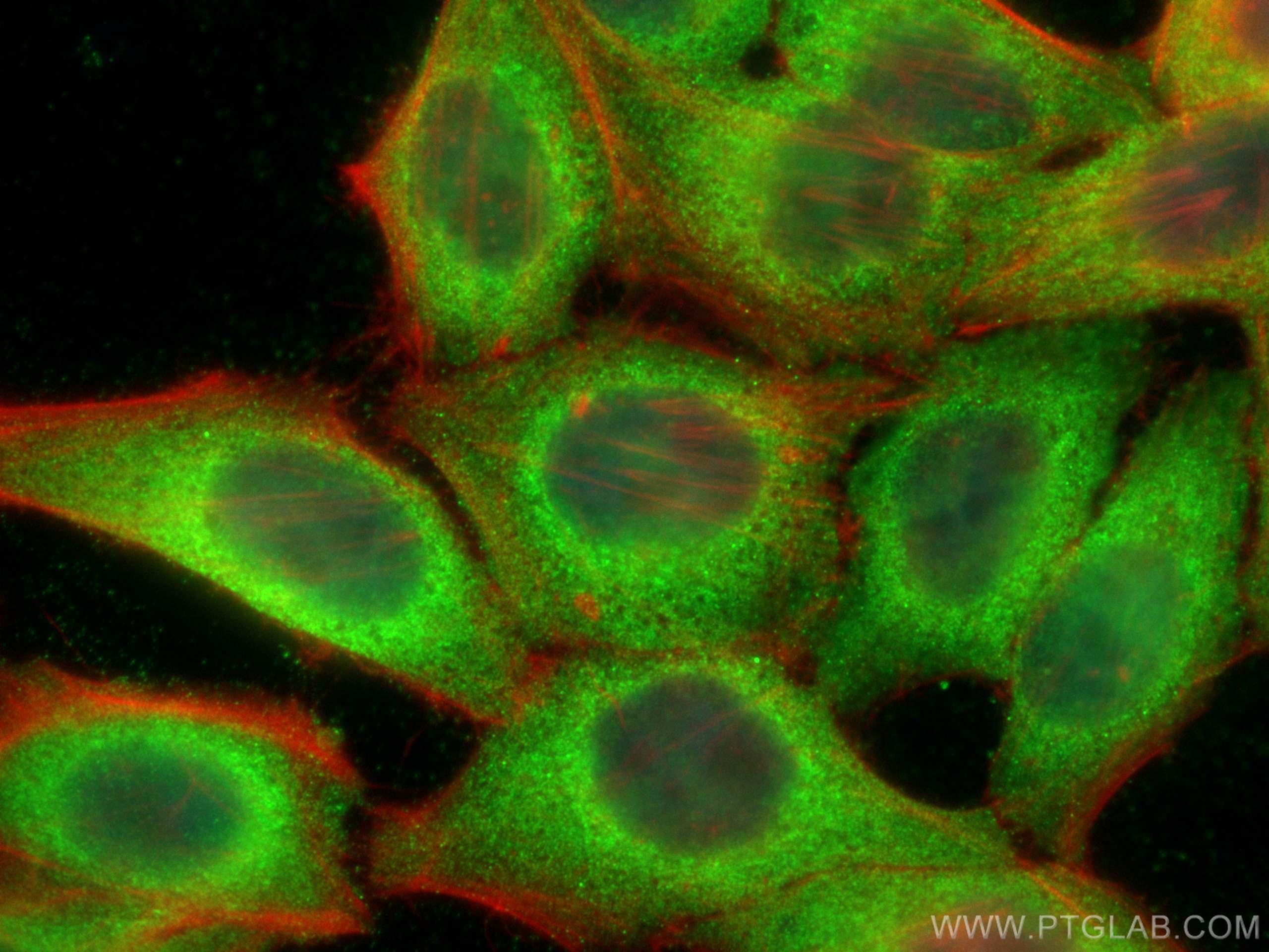 IF Staining of HepG2 using 28174-1-AP