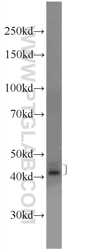 WB analysis of COLO 320 using 24941-1-AP