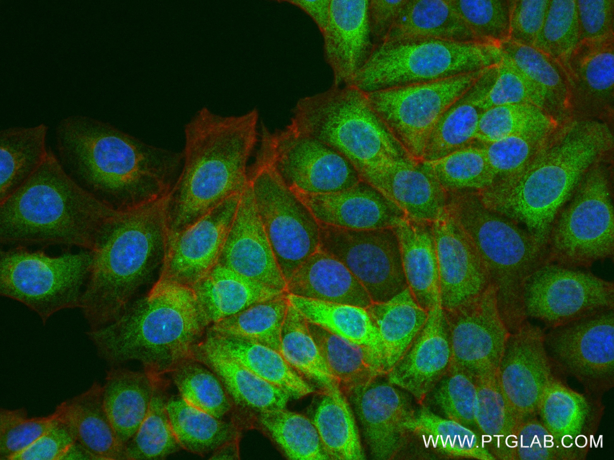 IF Staining of MCF-7 using 81468-5-RR (same clone as 81468-5-PBS)