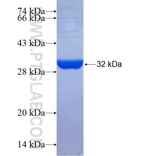 SCD5 fusion protein Ag25211 SDS-PAGE SCD5 fusion protein Ag25211 SDS-PAGE