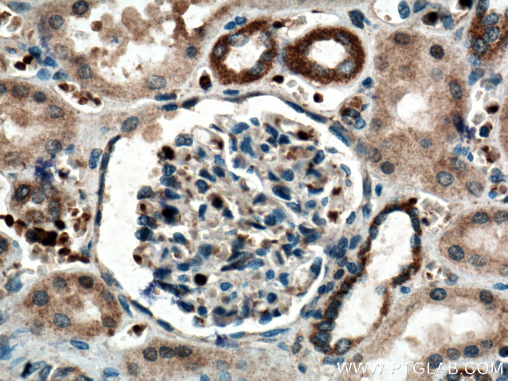 IHC staining of human kidney using 26582-1-AP