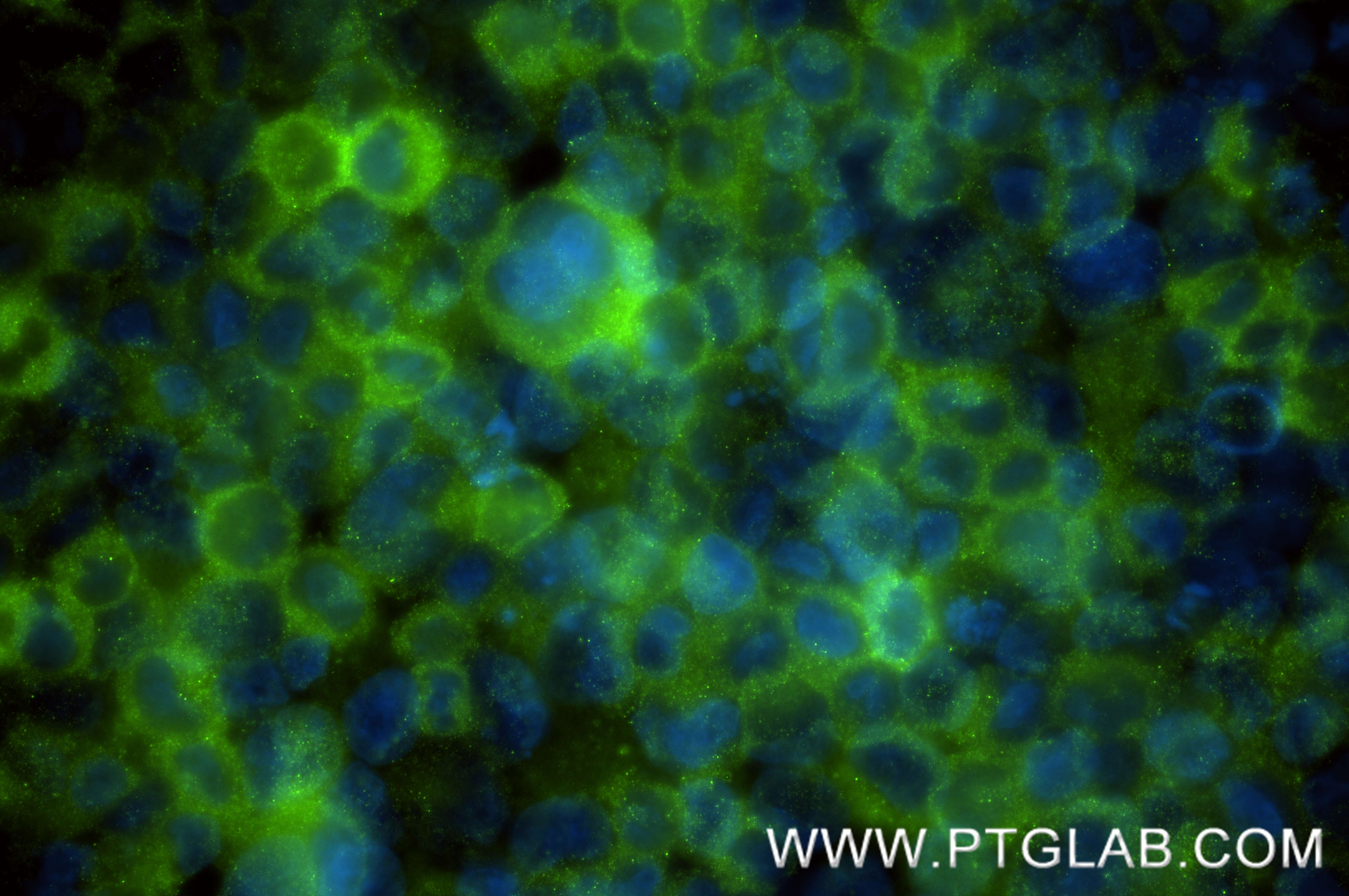 IF Staining of K-562 using 84118-7-RR IF Staining of K-562 using 84118-7-RR