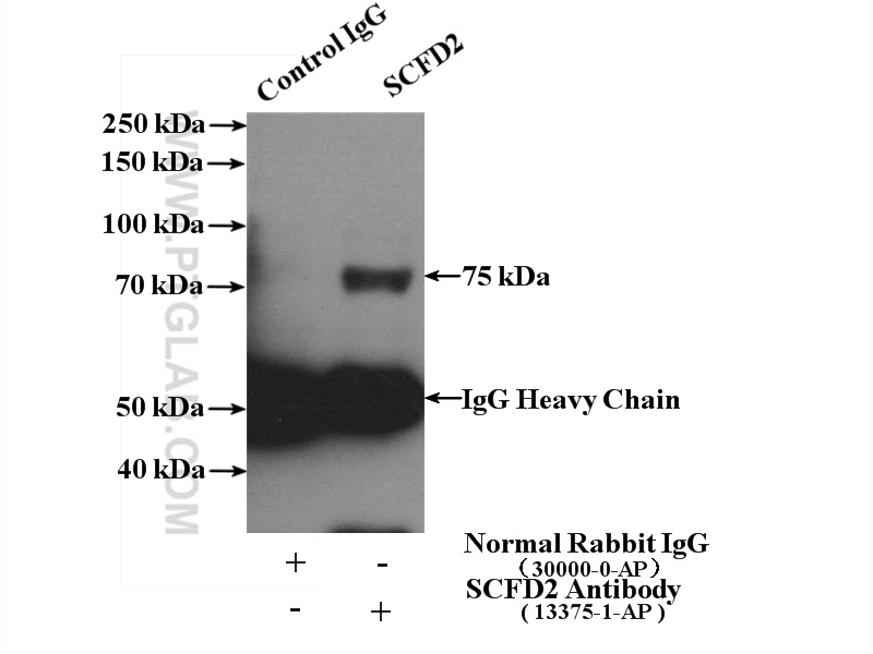 IP experiment of COLO 320 using 13375-1-AP