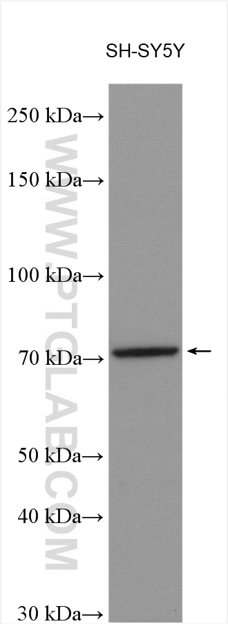 WB analysis of SH-SY5Y using 20357-1-AP